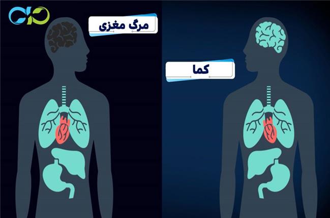 ۵ تفاوت مهم  کما و مرگ مغزی که خیلی‌ها نمی‌دانند