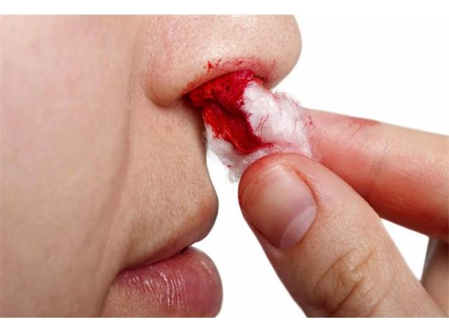 تجربه های وحشتناک چهره های معروف از عمل های جراحی زیبایی