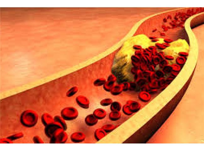 چطور کلسترول خون را کنترل کنیم