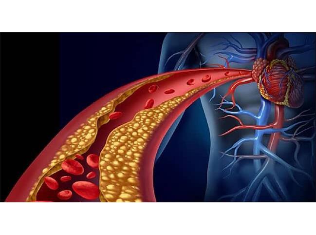 چطور کلسترول خون را کنترل کنیم