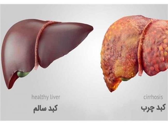 تاثیر ویرانگر  نوشابه بر کبد