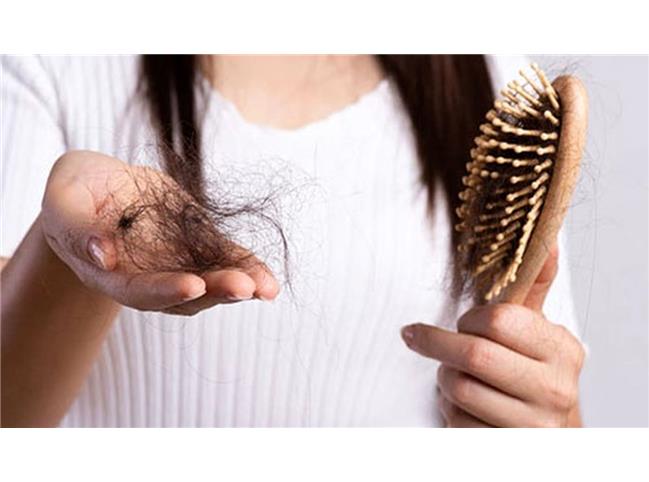 مهمترین دلایل ریزش مو چیست