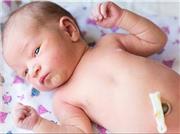 همه چیز درباره بند ناف نوزاد