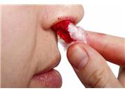 تجربه های وحشتناک چهره های معروف از عمل های جراحی زیبایی