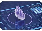 تحول تشخیص حمله قلبی با هوش مصنوعی ؟