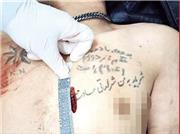 قمه قاتل روی خالکوبی 