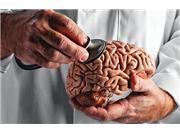 مهمترین علایم و نشانه های تومور مغزی چیست